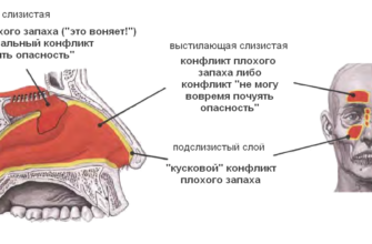 Потеря или снижение обоняния (гипоаносмия или аносмия)