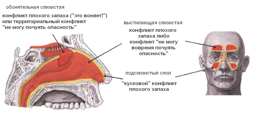 Потеря или снижение обоняния (гипоаносмия или аносмия)