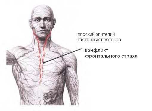 Ходжкин и «не-ходжкин» и что у них общего (http://gnm.teamforum.ru/viewtopic.php?f=89&t=438&p=991#p991)