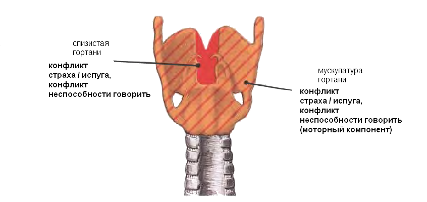 Рак гортани (карцинома, папилома), воспаление слизистой гортани (ларингит)